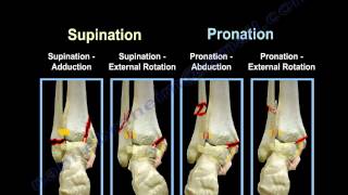 Ankle Fractures Lauge Hansen Introduction  Everything You Need To Know  Dr Nabil Ebraheim [upl. by Adalbert]