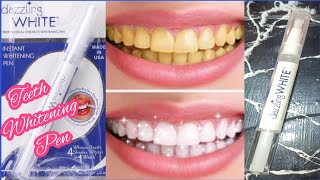 Teeth Whitening PenTeeth Whitening at home [upl. by Ysirhc]