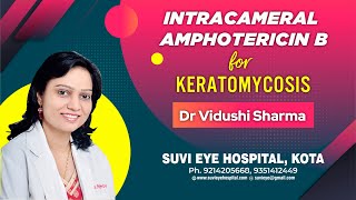 Intracameral Amphotericin B for Keratomycosis Dr Suresh K Pandey Suvi Eye Kota Indiampg [upl. by Airb143]