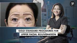 Upper Facial Rejuvenation Browlift Blepharoplasty Eyelid lift  Dr Shilpi Bhadani [upl. by Cerracchio923]