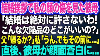 結婚挨拶で私の顔の傷を見た彼母「結婚は許さないわ！こんな欠陥品のどこがいいの？」→父「帰るか？」私「うん、でもその前に…」直後、彼母が顔面蒼白に…【スカッとする話】 [upl. by Nairred642]