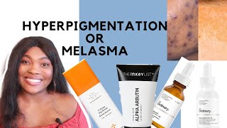 HYPERPIGMENTATION vs MELASMA  Best Treatments [upl. by Barnaba]