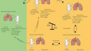 Difference Between Primary and Secondary Tuberculosis [upl. by Yensehc]