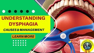 DysphagiaDifficulty in Swallowing  Definition Causes Investigation and Management [upl. by Elagiba]