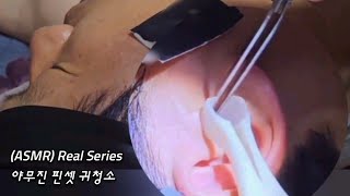 ASMR Real Series 야무진 핀셋귀청소 Cleaning ears with tweezers ピンセット耳掃除 [upl. by Slavin]