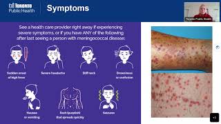 Protecting Yourself from Meningococcal Disease [upl. by Vaden]