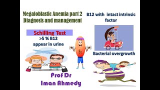 megaloblastic anemia part 2 Diagnosis treatment [upl. by Marlene]