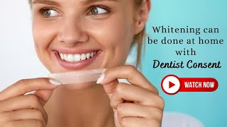 Whitening can be done at home with Dentist Consent  Dr Chirag Chamria  Teeth whitening ingredients [upl. by Tshombe]