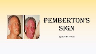 Pembertons sign pathophysiology cork hypothesis [upl. by Yurik]