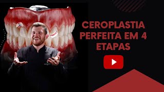 Ceroplastia Perfeita  Magno Sanches [upl. by Ellennaj827]