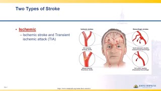 Ischemic Stroke  Lisa Klein [upl. by Nahtnamas]