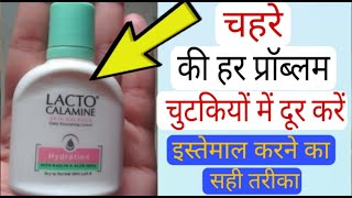 Lacto Calamine Face Lotion Skin Benefitsहिन्दी मैं Calamine lotion Remove Acne Pimples Dark spots [upl. by Newob]