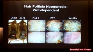 Dr George Cotsarelis Hair Follicle Stem Cells amp Skin Regeneration [upl. by Bindman605]