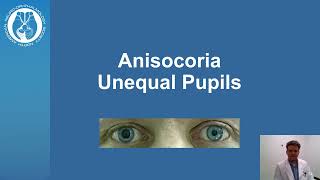 Anisocoria  Unequal Pupil Size [upl. by Leval]