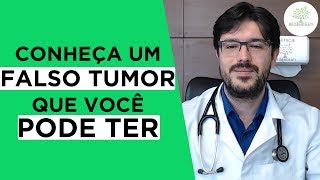 Pseudotumor  O Que é Cefaleia Por Pseudotumor Hipertensão Intracraniana [upl. by Gimble]