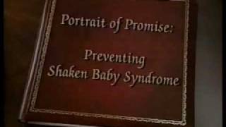 Shaken Baby Syndrome [upl. by Maise]