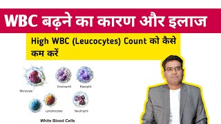 WBC बढ़ने का कारण और ईलाज  High WBC Leucocytes Count Causes and Treatment [upl. by Nirraj226]