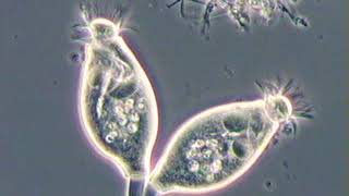 Opercularia articulata in activated sludge [upl. by Haelem]