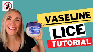 Vaseline For Lice Tutorial [upl. by Silbahc554]