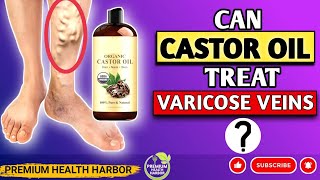 Castor Oils Trending Treatment for Varicose Veins  Castor Oil for Treating Varicose Veins [upl. by Salomone605]