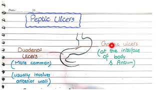 Peptic Ulcer Disease  Morphology [upl. by Eicnahc]