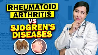 The Hidden Connection Between Rheumatoid Arthritis and Sjogrens Syndrome [upl. by Idel]