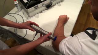 Tennis Elbow lateral epicondylitis Treatment with shockwave Zimmer enPuls [upl. by Bodwell264]