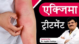 Foods triggering eczema flare up  Help your child avoid the itch  Dr Udhay Sidhu [upl. by Allin530]