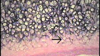 Cartilage and Bone Histology FreeMedEd [upl. by Ecnerat]