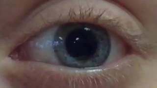 Pupil Dilation and Contraction [upl. by Gillian]