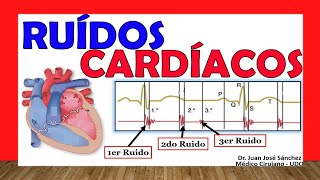 🥇 RUIDOS CARDÍACOS R1 R2 R3 y R4 ¡Fácil Explicación [upl. by Studley]