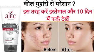 Alite anti acne face wash review in Hindi  मुँहासों और दाग़ धब्बो को मिटाये [upl. by Laure]