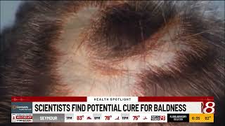 Scientists find potential cure for baldness [upl. by Payne124]