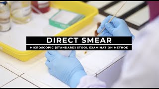 Direct Smear  Microscopic Standard Stool Examination Method [upl. by Aizek]