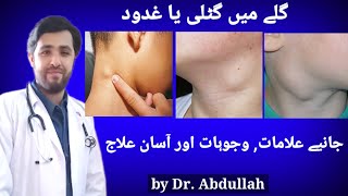 Swollen Lymph Nodes In Neck Symptoms Causes amp Treatment  Lymphadenopathy  Gale Ki Gilti Ya Ganth [upl. by Iphigenia]