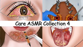 ASMR CARE ANIMATION COLLECTION 4  Eye Stone Removal Body modification Makeup Tonsil stone [upl. by Ycam]