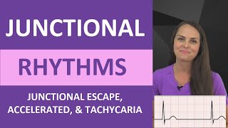 Junctional Rhythms Made Easy EKG Interpretation Nursing NCLEX ECG Review [upl. by Akihsal]