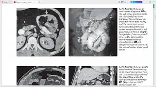 Peritoneum mesentery and abdominal wall imaging [upl. by Xena]