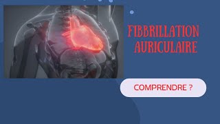 Comprendre la Fibrillation Auriculaire Explications et Exemples [upl. by Bette]