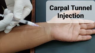 Carpal Tunnel Injection [upl. by Aniakudo]