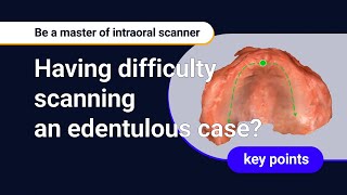 Mastering Intraloral Scanners  Edentulous scanning [upl. by Budge251]