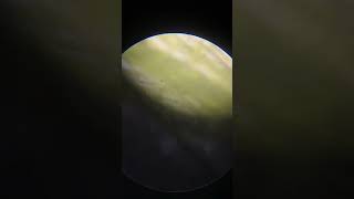 Spirogyra under microscope youtubeshorts viralvideo viralshorts recommended [upl. by Ajat]