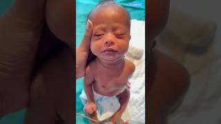 Down Syndrome Babycutebabyviralvideo [upl. by Hitoshi]