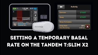 How To Set A Temporary Basal Rate On Tandem tslim X2 Insulin Pump [upl. by Akcirret918]