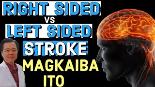 RightSided vs LeftSided Stroke Signs Magkaiba Ito Ano Mas Seryoso  By Doc Willie Ong [upl. by Ogires]