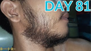 DAY 81  KIRKLAND MINOXIDIL BEARD JOURNEY [upl. by Aihsemaj519]