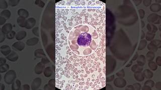 Observe 👀 Basophils Cells Seen In Microscope 🔬 shorts science ytshorts mbbs [upl. by Airtina]