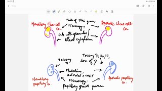 Renal cell carcinoma RCC  Pathology  Handwritten notes [upl. by Bithia]