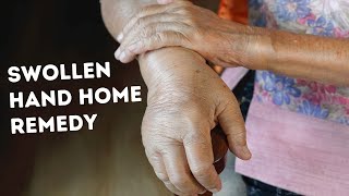 Hand Swelling Home Remedy What to do when Hand Swells [upl. by Chatterjee216]