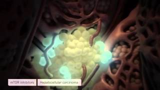 Medical Animation Liver Fibrosis and Cancer Oncology Animation [upl. by Mccafferty]